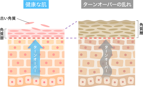 乱れたターンオーバー